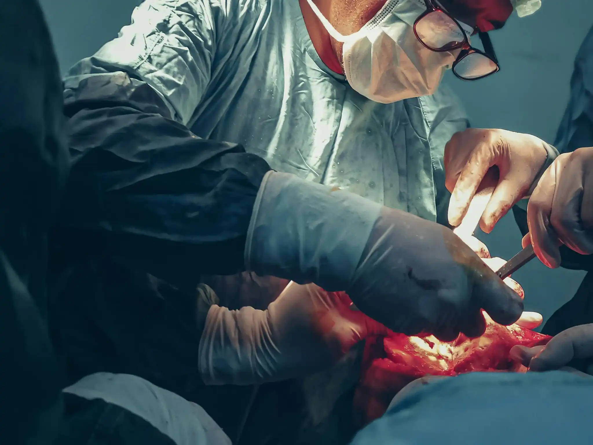 Neurosurgery